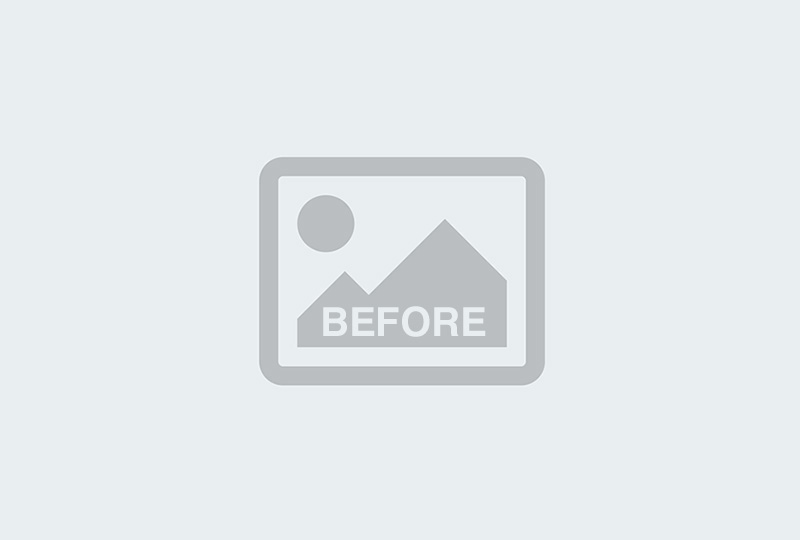Before Image: Mastopexy with Silicone Breast Augmentation - 