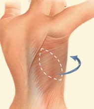 Autologous breast reconstruction Lone Tree