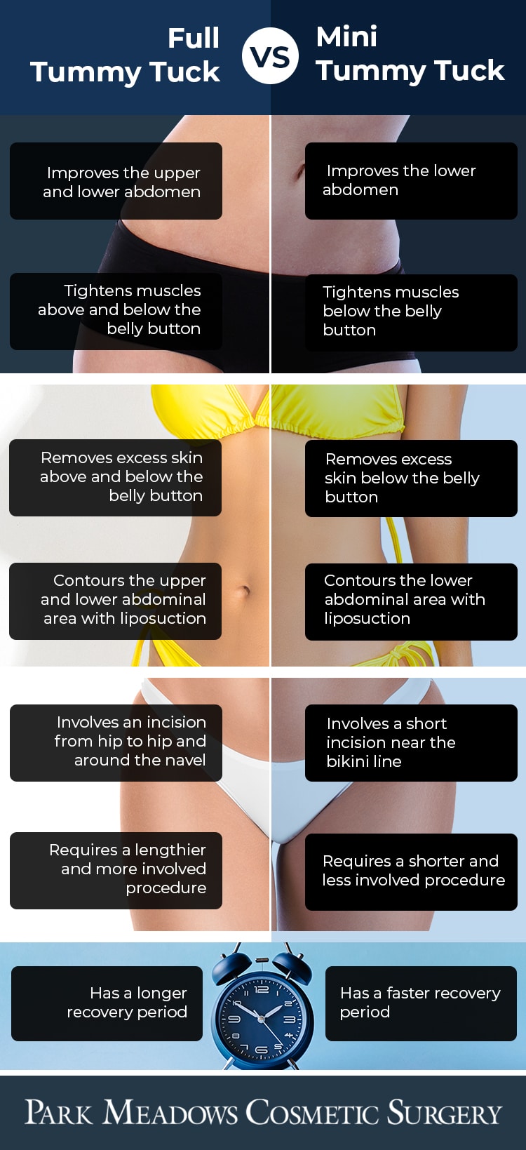 full & mini tummy tuck Highlands Ranch CO