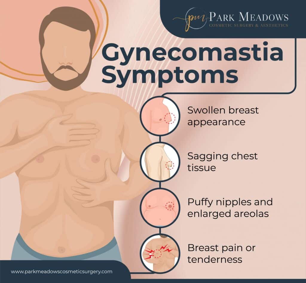 how to tell if you have gynecomastia 63458fdf6d88a