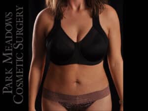 Abdominoplasty with Liposuction
