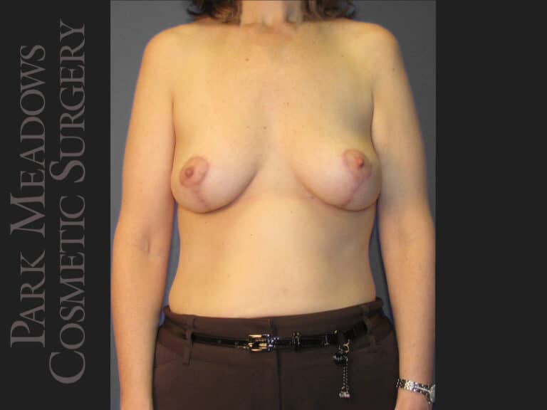 After Image