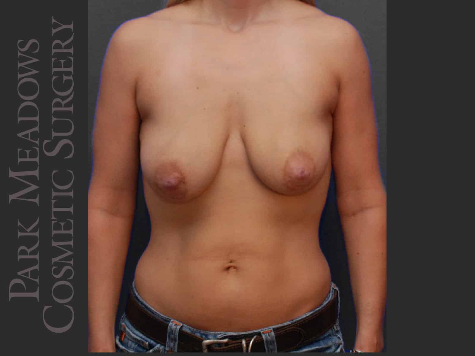 Before Image