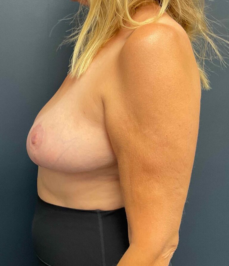 After Image