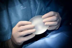 Breast implant removal