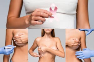 oncoplastic breast surgery