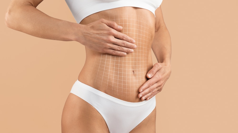 Abdominoplasty Lone Tree CO