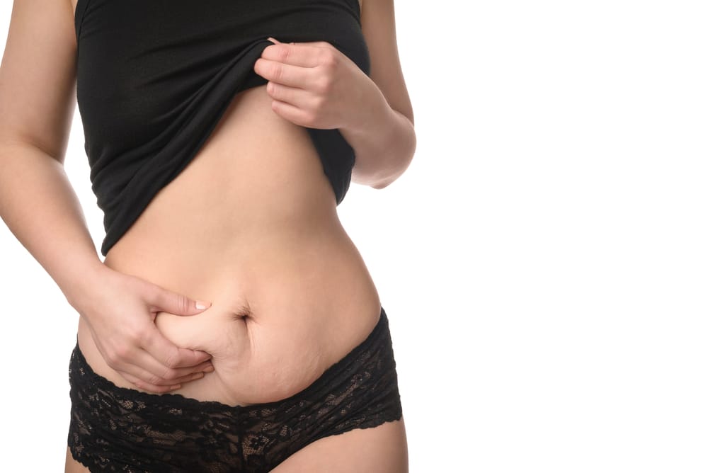 Woman pinching loose skin on her lower abdomen